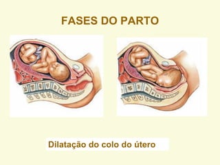 FASES DO PARTO
Dilatação do colo do útero
 