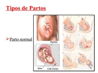 Tipos de Partos




 Parto normal
 