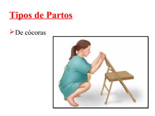 Tipos de Partos
 De cócoras
 