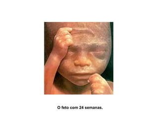 O feto com 24 semanas. 