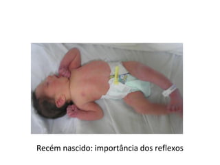 Recém nascido: importância dos reflexos
 