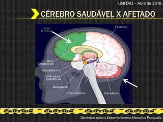 CÉREBRO SAUDÁVEL X AFETADO
UNITAU – Abril de 2016
Seminário sobre o Desenvolvimento Mental da Psicopatia
 