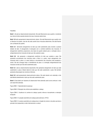 FIGURAS
Bebê 1. A está se desenvolvendo tipicamente. Ele está flexionando seus quadris e mantendo
sua coluna lombar apoiada através dos seus músculos abdominais.
Bebê 1.B está apresentando desenvolvimento atípico. Ele está flexionando seus quadris com
os flexores de quadris, mas ele não está usando seus músculos abdominais. Ele está fixando
com os flexores de quadris.
Bebê 2.A demonstra alongamento do lado que está sustentando peso durante a postura
deitado de lado. O alongamento é alcançado com o controle excêntrico dos músculos. O
alongamento excêntrico proporciona uma base de suporte estável para a contração ativa e
antigravitacional dos músculos do lado que não sustenta o peso.
Bebê 2.B não apresenta o alongamento excêntrico do lado que sustenta o peso. Ele
apresenta encurtamento dos músculos entre o fêmur e a pelve, maior alongamento dos
músculos entre a pelve e a caixa torácica e encurtamento dos músculos entre escápula e
úmero. Ele não consegue fazer a transferência de peso e a contração antigravitacional dos
músculos do lado que não está sustentando peso.
Bebê 3.A está se desenvolvendo tipicamente. Ele apresenta alongamento do lado que está
sustentando o peso e flexão lateral do lado que não está sustentando o peso. Ele também
apresenta dissociação dos membros inferiores.
Bebê 3.B está apresentando desenvolvimento atípico. Ele está rolando com extensão e não
está fletindo lateralmente o lado que não está sustentando peso.
Bebê C: Este bebê com hipotonia irá desenvolver forte extensão axial se ele continuar a rolar
com esta forte extensão.
Figura DMA 1: Hiperextensão de pescoço
Figura DMA 2: Elevação dos ombros para estabilizar a cabeça
Figura DMA 3: Ausência do controle de cabeça quando retira-se manualmente a elevação
escapular
Figura DMA 4: A posição assimétrica de cabeça pode estimular o RTCA
Figura DMA 5: A postura assimétrica de cabeça leva à rotação da coluna e da pelve que leva a
pernade cima (esquerda) a rodar internamente e a aduzir.
 