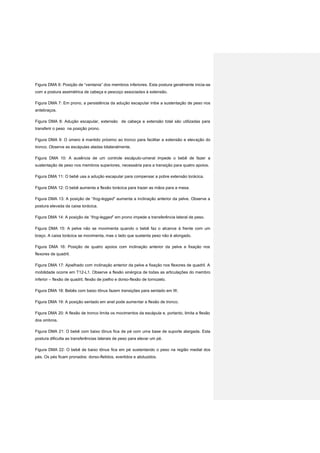 Figura DMA 6: Posição de “ventania” dos membros inferiores. Esta postura geralmente inicia-se
com a postura assimétrica de cabeça e pescoço associadas à extensão.
Figura DMA 7: Em prono, a persistência da adução escapular inibe a sustentação de peso nos
antebraços.
Figura DMA 8: Adução escapular, extensão de cabeça e extensão total são utilizadas para
transferir o peso na posição prono.
Figura DMA 9: O úmero é mantido próximo ao tronco para facilitar a extensão e elevação do
tronco. Observe as escápulas aladas bilateralmente.
Figura DMA 10: A ausência de um controle escápulo-umeral impede o bebê de fazer a
sustentação de peso nos membros superiores, necessária para a transição para quatro apoios.
Figura DMA 11: O bebê usa a adução escapular para compensar a pobre extensão torácica.
Figura DMA 12: O bebê aumenta a flexão torácica para trazer as mãos para a mesa.
Figura DMA 13: A posição de “frog-legged” aumenta a inclinação anterior da pelve. Observe a
postura elevada da caixa torácica.
Figura DMA 14: A posição de “frog-legged” em prono impede a transferência lateral de peso.
Figura DMA 15: A pelve não se movimenta quando o bebê faz o alcance à frente com um
braço. A caixa torácica se movimenta, mas o lado que sustenta peso não é alongado.
Figura DMA 16: Posição de quatro apoios com inclinação anterior da pelve e fixação nos
flexores de quadril.
Figura DMA 17: Ajoelhado com inclinação anterior da pelve e fixação nos flexores de quadril. A
mobilidade ocorre em T12-L1. Observe a flexão sinérgica de todas as articulações do membro
inferior – flexão de quadril, flexão de joelho e dorso-flexão de tornozelo.
Figura DMA 18: Bebês com baixo tônus fazem transições para sentado em W.
Figura DMA 19: A posição sentado em anel pode aumentar a flexão de tronco.
Figura DMA 20: A flexão de tronco limita os movimentos da escápula e, portanto, limita a flexão
dos ombros.
Figura DMA 21: O bebê com baixo tônus fica de pé com uma base de suporte alargada. Esta
postura dificulta as transferências laterais de peso para elevar um pé.
Figura DMA 22: O bebê de baixo tônus fica em pé sustentando o peso na região medial dos
pés. Os pés ficam pronados: dorso-fletidos, evertidos e abduzidos.
 