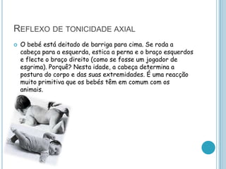 REFLEXO DE TONICIDADE AXIAL
   O bebé está deitado de barriga para cima. Se roda a
    cabeça para a esquerda, estica a perna e o braço esquerdos
    e flecte o braço direito (como se fosse um jogador de
    esgrima). Porquê? Nesta idade, a cabeça determina a
    postura do corpo e das suas extremidades. É uma reacção
    muito primitiva que os bebés têm em comum com os
    animais.
 