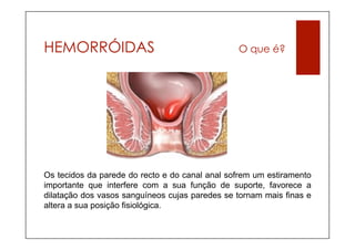 HEMORRÓIDAS                                     O que é?




Os tecidos da parede do recto e do canal anal sofrem um estiramento
importante que interfere com a sua função de suporte, favorece a
dilatação dos vasos sanguíneos cujas paredes se tornam mais finas e
altera a sua posição fisiológica.
 