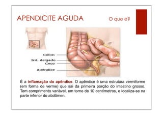 APENDICITE AGUDA                                 O que é?




É a inflamação do apêndice. O apêndice é uma estrutura vermiforme
(em forma de verme) que sai da primeira porção do intestino grosso.
Tem comprimento variável, em torno de 10 centímetros, e localiza-se na
parte inferior do abdômen.
 