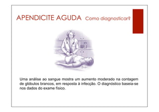 APENDICITE AGUDA                     Como diagnosticar?




Uma análise ao sangue mostra um aumento moderado na contagem
de glóbulos brancos, em resposta à infecção. O diagnóstico baseia-se
nos dados do exame físico.
 