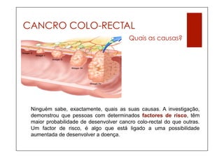CANCRO COLO-RECTAL
                                        Quais as causas?




 Ninguém sabe, exactamente, quais as suas causas. A investigação,
 demonstrou que pessoas com determinados factores de risco, têm
 maior probabilidade de desenvolver cancro colo-rectal do que outras.
 Um factor de risco, é algo que está ligado a uma possibilidade
 aumentada de desenvolver a doença.
 
