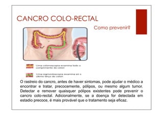 CANCRO COLO-RECTAL
                                         Como prevenir?




O rastreio do cancro, antes de haver sintomas, pode ajudar o médico a
encontrar e tratar, precocemente, pólipos, ou mesmo algum tumor.
Detectar e remover quaisquer pólipos existentes pode prevenir o
cancro colo-rectal. Adicionalmente, se a doença for detectada em
estadio precoce, é mais provável que o tratamento seja eficaz.
 