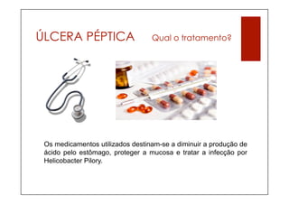 ÚLCERA PÉPTICA                    Qual o tratamento?




 Os medicamentos utilizados destinam-se a diminuir a produção de
 ácido pelo estômago, proteger a mucosa e tratar a infecção por
 Helicobacter Pilory.
 