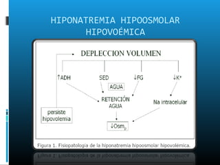 HIPONATREMIA HIPOOSMOLAR
       HIPOVOÉMICA
 