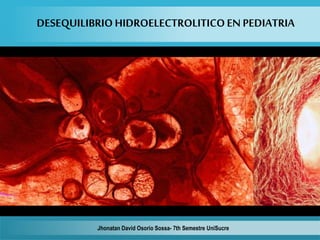 DESEQUILIBRIOHIDROELECTROLITICOEN PEDIATRIA
Jhonatan David Osorio Sossa- 7th Semestre UniSucre
 