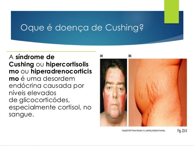 Desequilibrios hidroeletroliticos