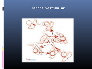 Marcha Vestibular
 