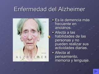 Enfermedad del Alzheimer ,[object Object],[object Object],[object Object]