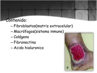 Contenido:
– Fibroblastos(matriz extracelular)
– Macrófagos(sistema inmune)
– Colágeno
– Fibronectina
– Acido hialuronico
 