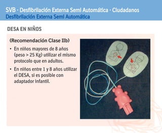 DESA EN NIÑOS
SVB · Desfibrilación Externa Semi Automática · Ciudadanos
Desfibrilación Externa Semi Automática
(Recomendación Clase IIb)
• En niños mayores de 8 años
(peso > 25 Kg) utilizar el mismo
protocolo que en adultos.
• En niños entre 1 y 8 años utilizar
el DESA, si es posible con
adaptador infantil.
 