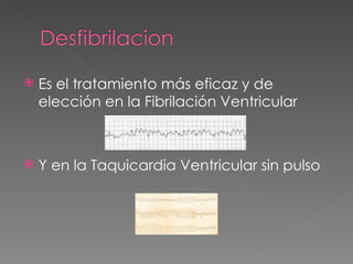    Es el tratamiento más eficaz y de
    elección en la Fibrilación Ventricular



   Y en la Taquicardia Ventricular sin pulso
 