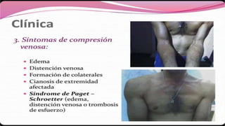 A d d t i t l e
Vestibulum ante ipsum primis in faucibus orci luctus et
ultrices posuere cubilia Curae; Donec velit neque,
auctor sit amet aliquam vel, ullamcorper sit amet ligula.
Nulla quis lorem ut libero malesuada feugiat.
Vestibulum ac diam sit amet quam vehicula
ORCI LUCTUS ET ULTRICES
POSUERE CUBILIA CURAE;
DONEC
 