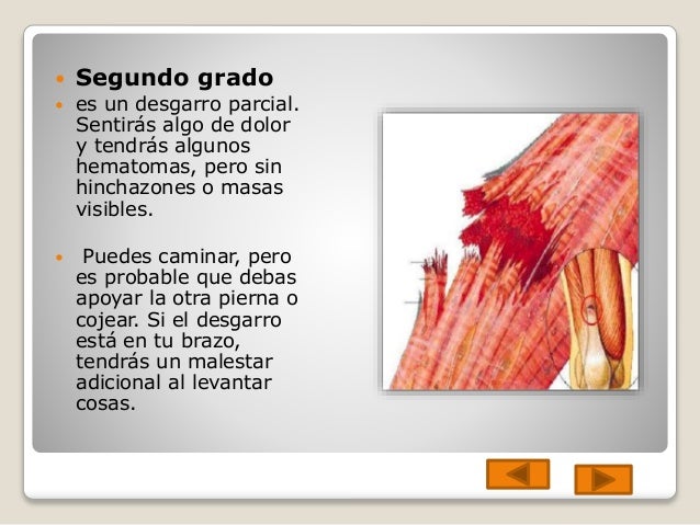 tratamiento para desgarro grado 2