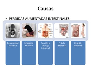 Causas
• PERDIDAS AUMENTADAS INTESTINALES




Enfermedad   Síndrome    Succión o      Fístula     Oclusión
 diarreica    emético     drenaje     intestinal   intestinal
                         intestinal
 