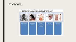 ETIOLOGIA
 