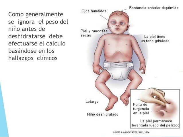 Resultado de imagen de niño deshidratado sintomas