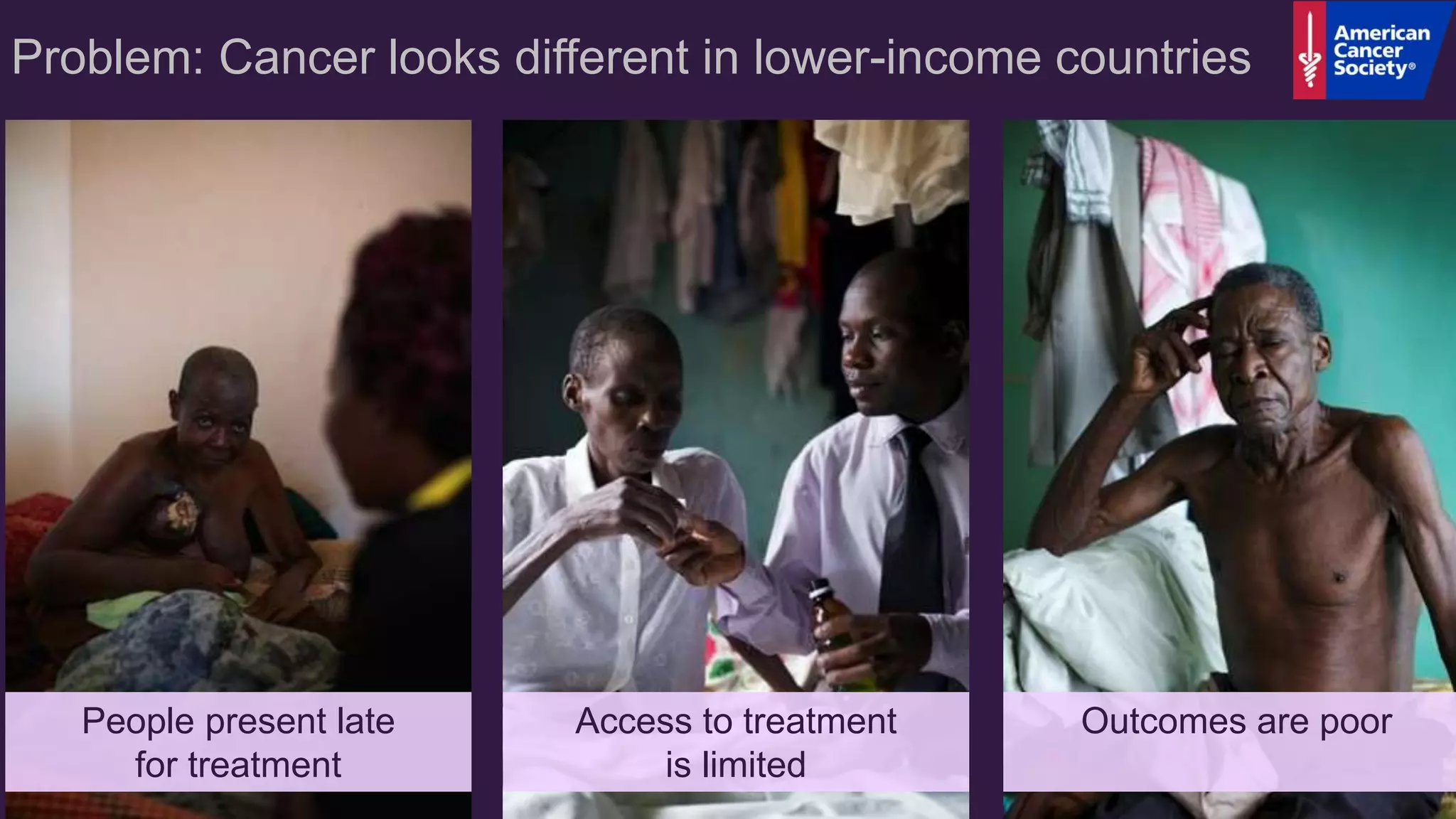 Problem: Cancer looks different in lower-income countries
People present late
for treatment
Outcomes are poorAccess to treatment
is limited
 