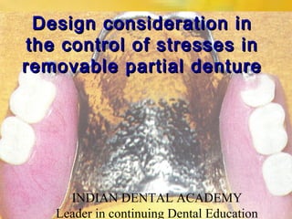 Design consideration inDesign consideration in
the control of stresses inthe control of stresses in
removable partial dentureremovable partial denture
INDIAN DENTAL ACADEMY
Leader in continuing Dental Education
 
