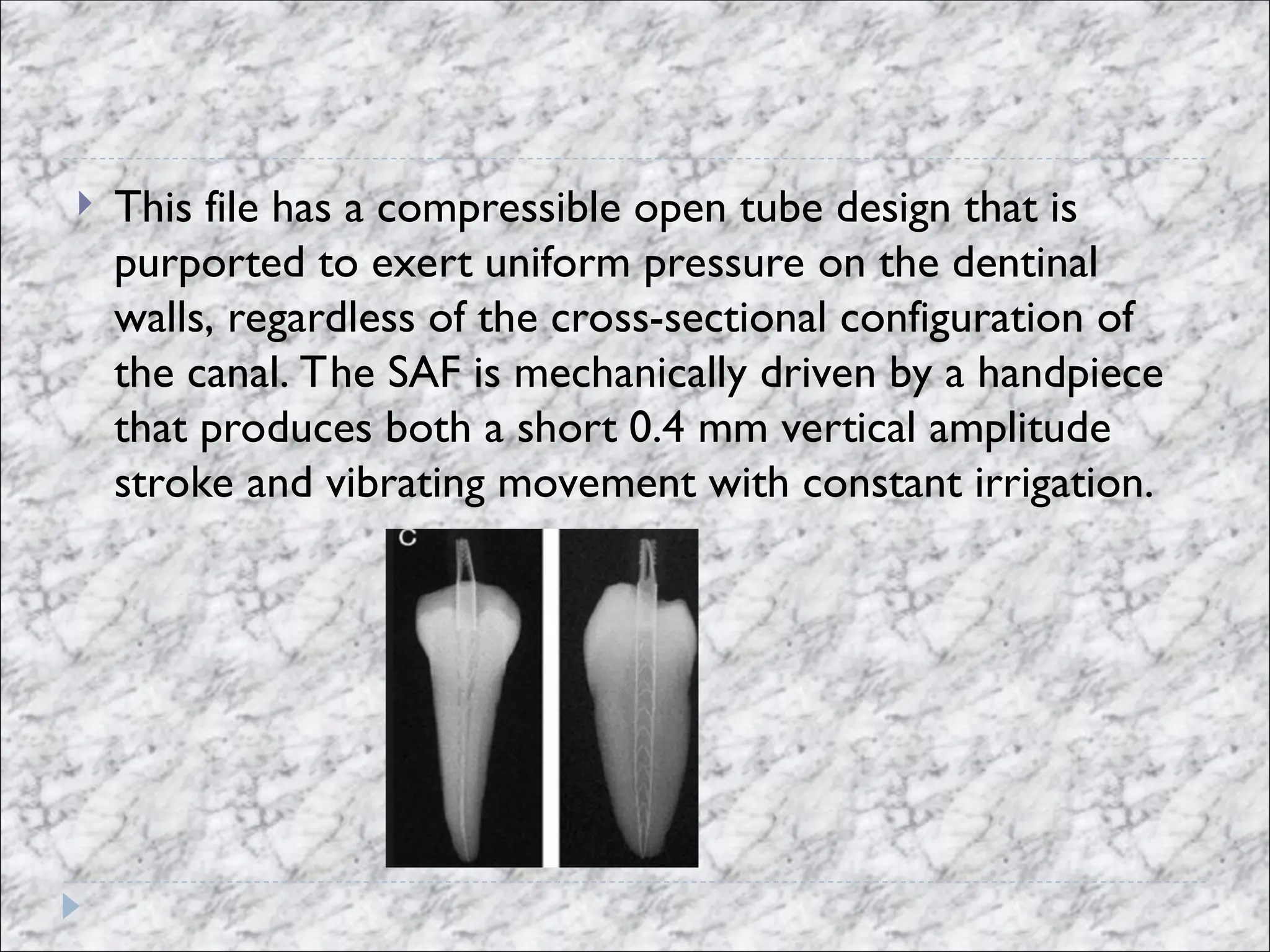  This file has a compressible open tube design that is
purported to exert uniform pressure on the dentinal
walls, regardless of the cross-sectional configuration of
the canal. The SAF is mechanically driven by a handpiece
that produces both a short 0.4 mm vertical amplitude
stroke and vibrating movement with constant irrigation.
 
