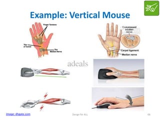 Example: Vertical Mouse

Image: dhgate.com

Design for ALL

66

 