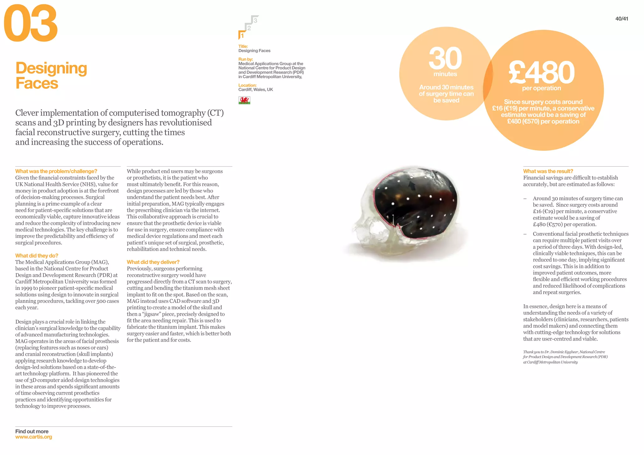 Designing
Faces
Clever implementation of computerised tomography (CT)
scans and 3D printing by designers has revolutionised
facial reconstructive surgery, cutting the times
and increasing the success of operations.
Find out more
www.cartis.org
While product end users may be surgeons
or prosthetists, it is the patient who
must ultimately benefit. For this reason,
design processes are led by those who
understand the patient needs best. After
initial preparation, MAG typically engages
the prescribing clinician via the internet.
This collaborative approach is crucial to
ensure that the prosthetic device is viable
for use in surgery, ensure compliance with
medical device regulations and meet each
patient’s unique set of surgical, prosthetic,
rehabilitation and technical needs.
What did they deliver?
Previously, surgeons performing
reconstructive surgery would have
progressed directly from a CT scan to surgery,
cutting and bending the titanium mesh sheet
implant to fit on the spot. Based on the scan,
MAG instead uses CAD software and 3D
printing to create a model of the skull and
then a “jigsaw” piece, precisely designed to
fit the area needing repair. This is used to
fabricate the titanium implant. This makes
surgery easier and faster, which is better both
for the patient and for costs.
What was the problem/challenge?
Given the financial constraints faced by the
UK National Health Service (NHS), value for
money in product adoption is at the forefront
of decision-making processes. Surgical
planning is a prime example of a clear
need for patient-specific solutions that are
economically viable, capture innovative ideas
and reduce the complexity of introducing new
medical technologies. The key challenge is to
improve the predictability and efficiency of
surgical procedures.
What did they do?
The Medical Applications Group (MAG),
based in the National Centre for Product
Design and Development Research (PDR) at
Cardiff Metropolitan University was formed
in 1999 to pioneer patient-specific medical
solutions using design to innovate in surgical
planning procedures, tackling over 500 cases
each year.
Design plays a crucial role in linking the
clinician’s surgical knowledge to the capability
of advanced manufacturing technologies.
MAG operates in the areas of facial prosthesis
(replacing features such as noses or ears)
and cranial reconstruction (skull implants)
applying research knowledge to develop
design-led solutions based on a state-of-the-
art technology platform. It has pioneered the
use of 3D computer aided design technologies
in these areas and spends significant amounts
of time observing current prosthetics
practices and identifying opportunities for
technology to improve processes.
Title:
Designing Faces
Run by:
Medical Applications Group at the
National Centre for Product Design
and Development Research (PDR)
in Cardiff Metropolitan University,
Location:
Cardiff, Wales, UK
2
3
1
40/41
What was the result?
Financial savings are difficult to establish
accurately, but are estimated as follows:
–– Around 30 minutes of surgery time can
be saved. Since surgery costs around
£16 (€19) per minute, a conservative
estimate would be a saving of
£480 (€570) per operation.
–– Conventional facial prosthetic techniques
can require multiple patient visits over
a period of three days. With design-led,
clinically viable techniques, this can be
reduced to one day, implying significant
cost savings. This is in addition to
improved patient outcomes, more
flexible and efficient working procedures
and reduced likelihood of complications
and repeat surgeries.
In essence, design here is a means of
understanding the needs of a variety of
stakeholders (clinicians, researchers, patients
and model makers) and connecting them
with cutting-edge technology for solutions
that are user-centred and viable.
ThankyoutoDr.DominicEggbeer,NationalCentre
forProductDesignandDevelopmentResearch(PDR)
atCardiffMetropolitanUniversity
Around 30 minutes
of surgery time can
be saved Since surgery costs around
£16 (€19) per minute, a conservative
estimate would be a saving of
£480 (€570) per operation
£480per operation
30minutes
03
 
