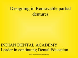 Designing in Removable partial
dentures
INDIAN DENTAL ACADEMY
Leader in continuing Dental Education
www.indiandentalacademy.com
 