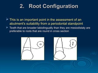 Root Configuration DESIGNING AND PLANNING CROWN AND BRIDGES.ppt