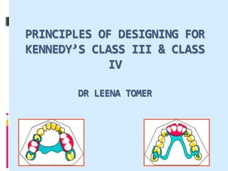 PRINCIPLES OF DESIGNING FOR
KENNEDY’S CLASS III & CLASS
IV
DR LEENA TOMER
 