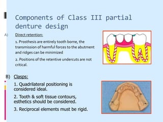 Class 3 Rpd Designing for kennedys cl iii & iv | PPT
