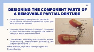 Denture Design Form Comprehensive Guide to Designing Removable Partial Dentures: Principles ...