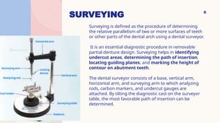 Comprehensive Guide to Designing Removable Partial Dentures: Principles ...