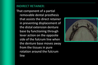 Retainer In Rpd Designing of rpd | PPTX
