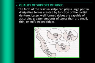 Sufficient Ridges Designing of rpd | PPTX