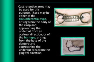Cast Frame Rpd Class Iv Designing of rpd | PPTX