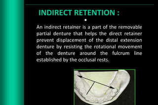 Long Box Rests For Rotational Path Rpd Designing of rpd | PPTX