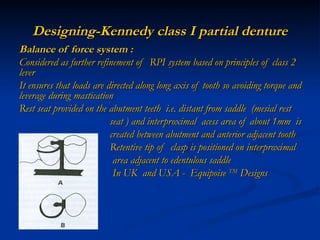 Rpd Design Rpi designing of rpd.ppt designing of denture | PPT