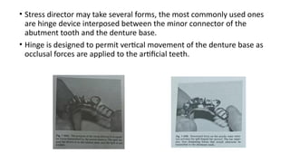Denture Design Form designing principles of Removable partial denture.pptx