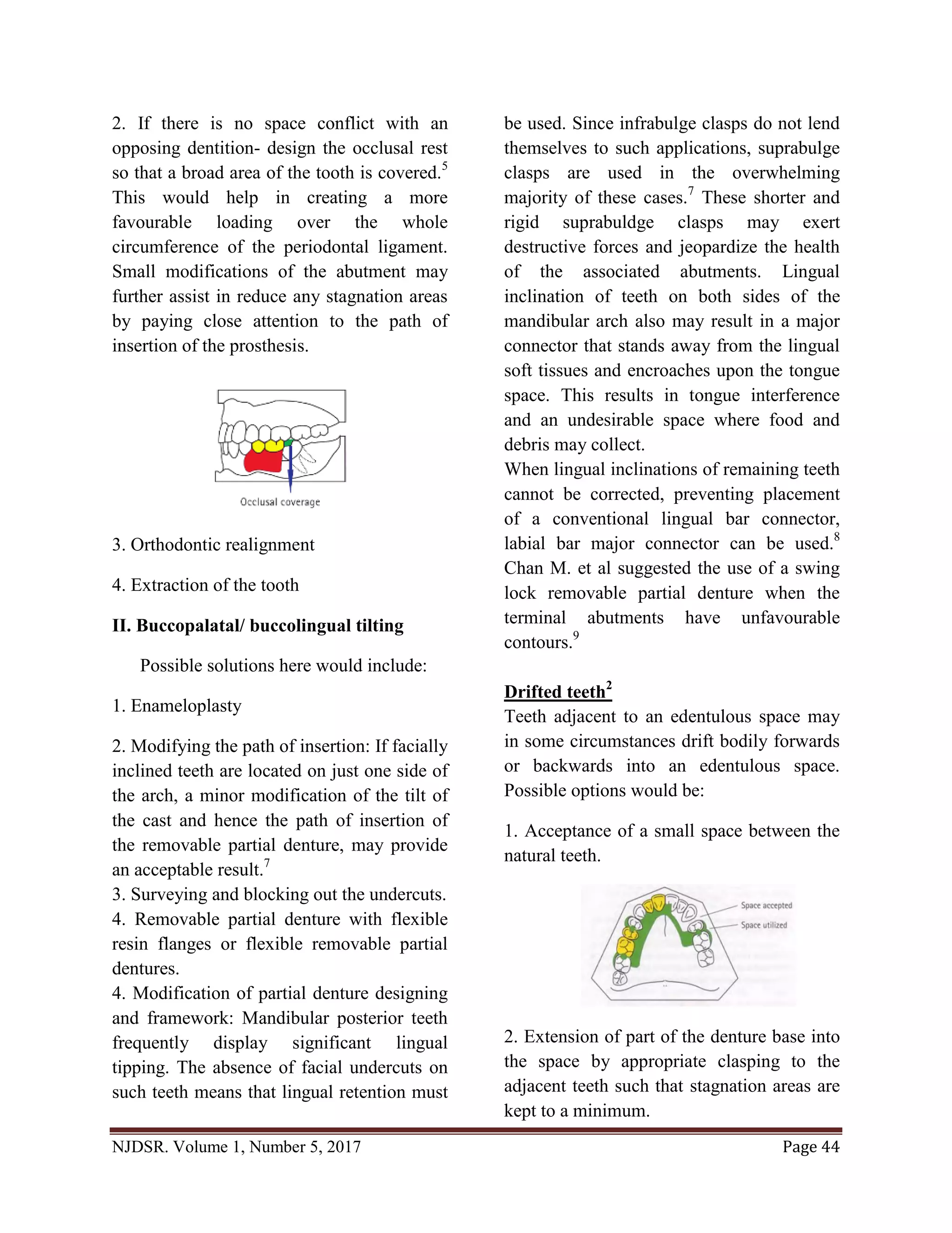 Designing removable partial dentures around difficult dentition | PDF