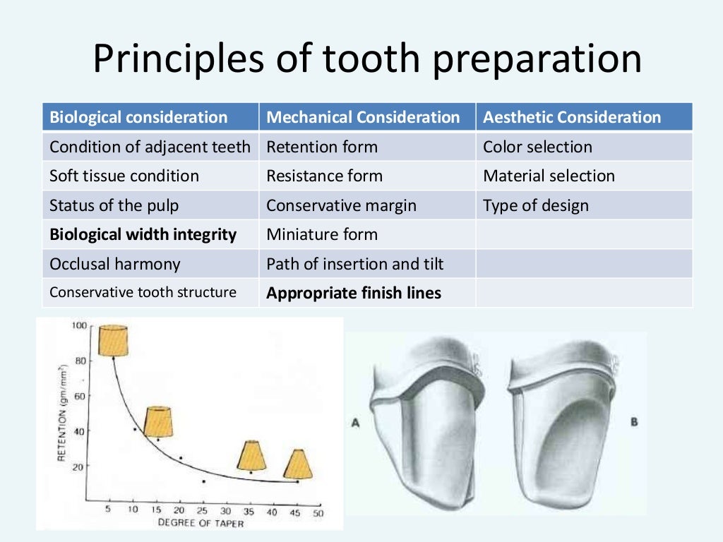 Design of a fixed Partial Denture (with Abutment Tooth Preparation)