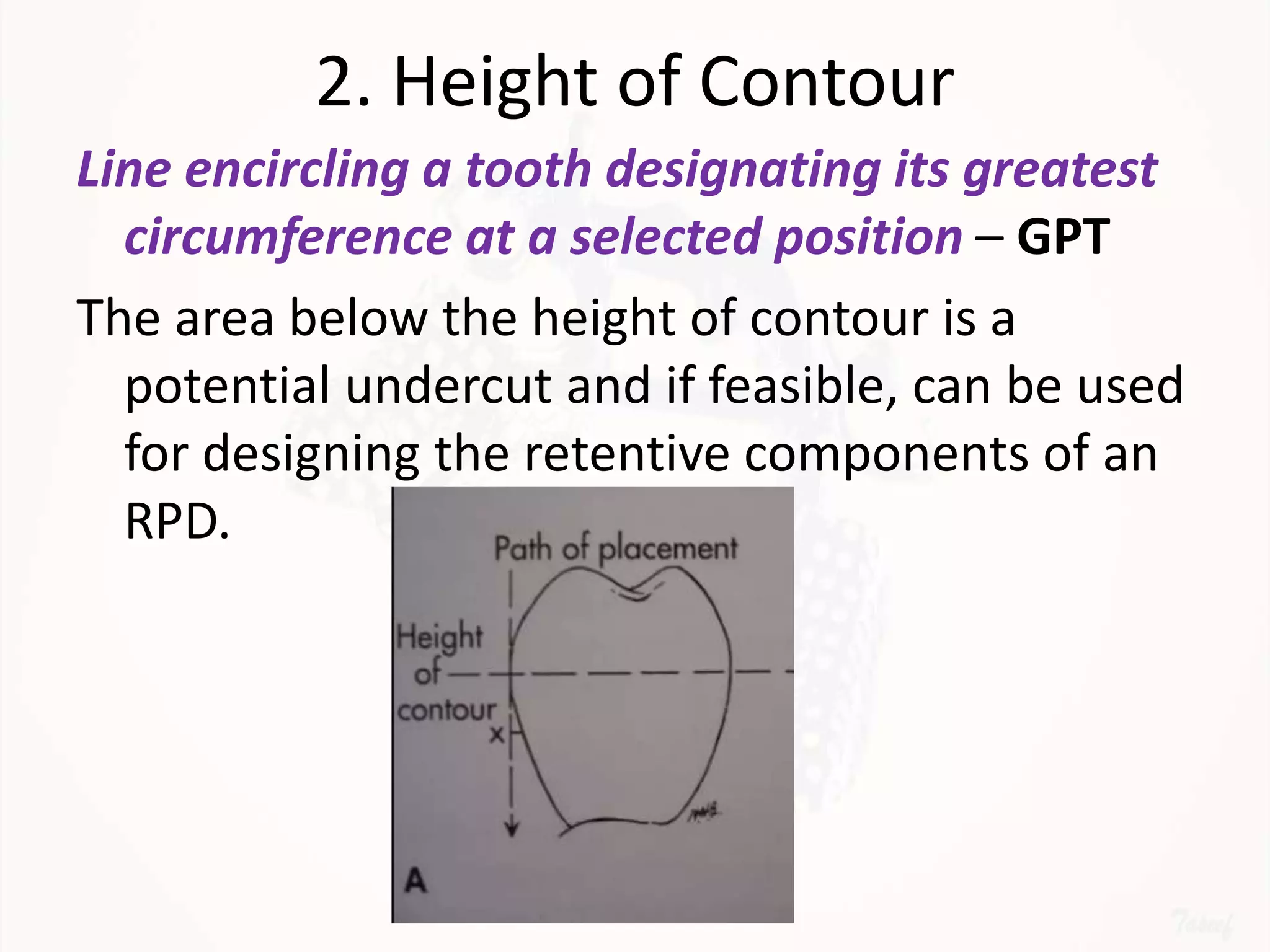 Designing a Removable Partial Denture (Kennedy's Classification) | PPTX
