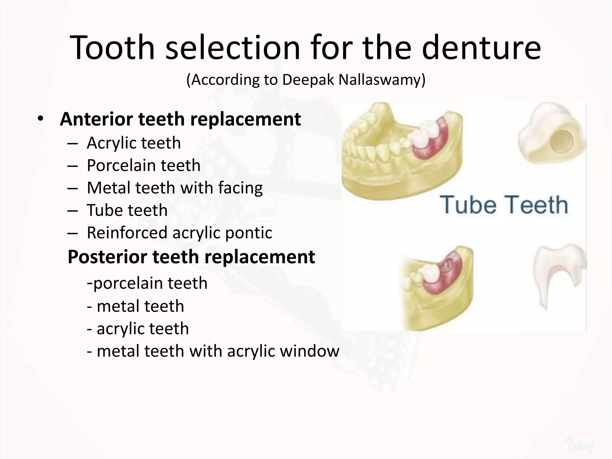 Designing a Removable Partial Denture (Kennedy's Classification)