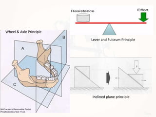 Wheel & Axle Principle
Lever and Fulcrum Principle
Inclined plane principle
 